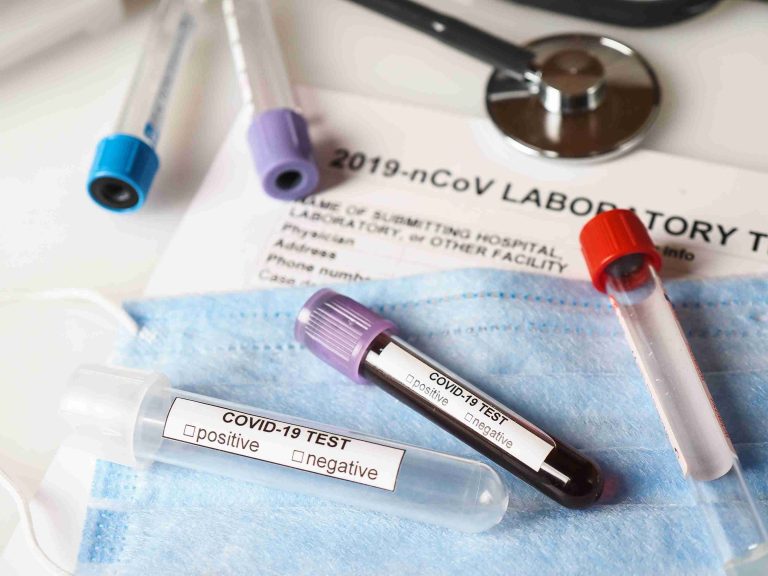 COVID-19 vials for testing.