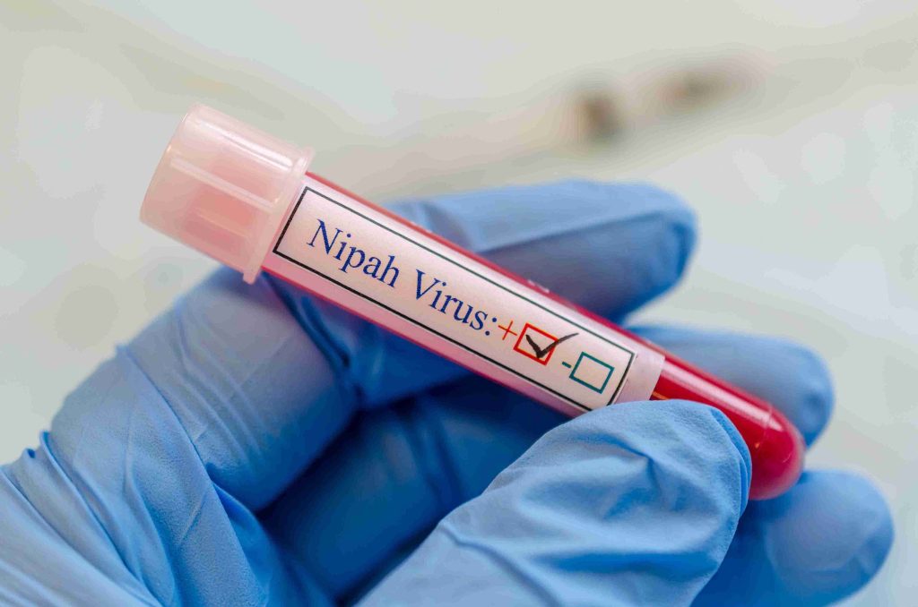 Blood vial showing positive for Nipah virus.
