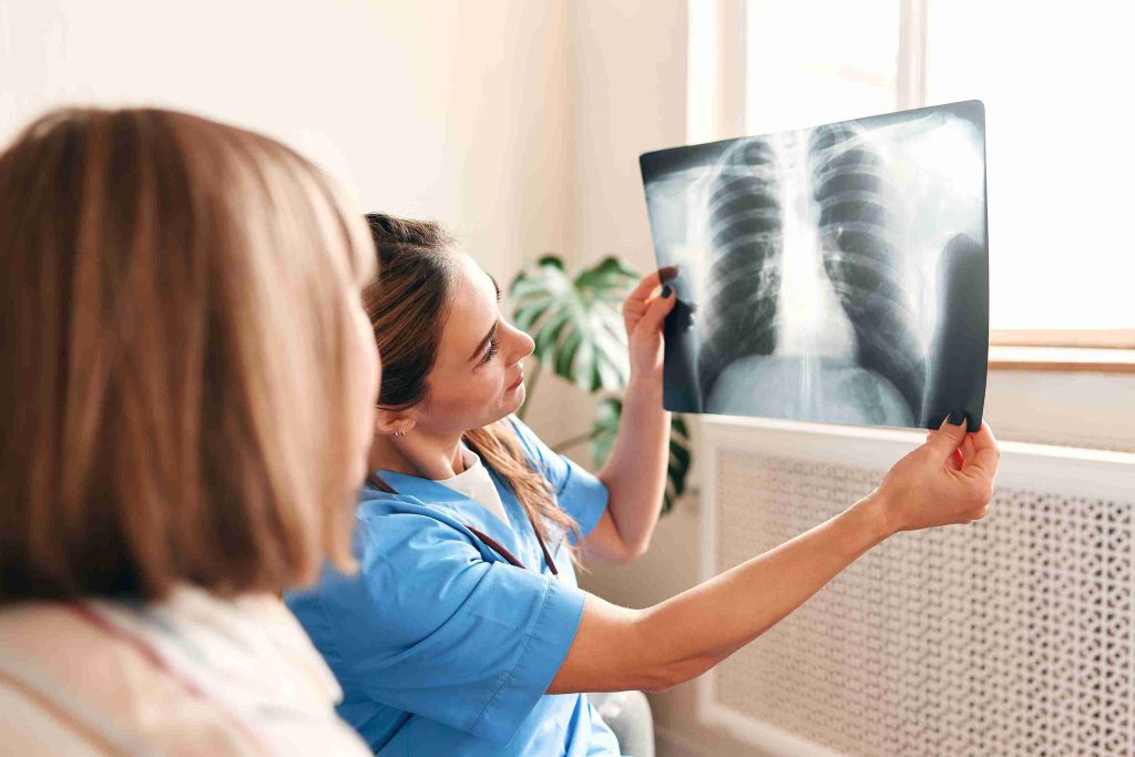 Healthcare workers looking at an X-ray of the lungs.