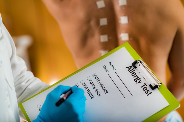 Healthcare worker conducting allergy testing.