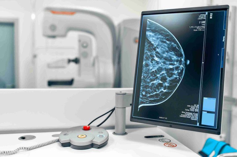 Image of a mammogram result.